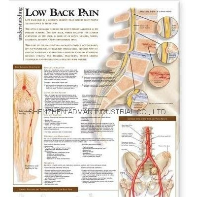 low back pain--3D RELIEF WALL MEDICAL/PHARMA CHART/POSTERpicture1