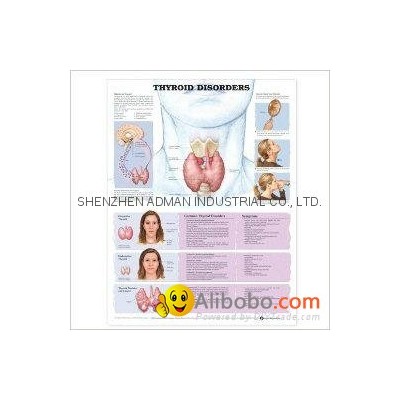THYROID DISORDERS--3D RELIEF WALL MEDICAL/PHARMA CHART/POSTERpicture1